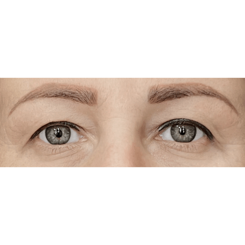 Miszczyk1A-1-aspect-ratio-500-500