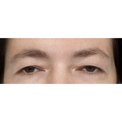 Miszczyk1A-aspect-ratio-500-500