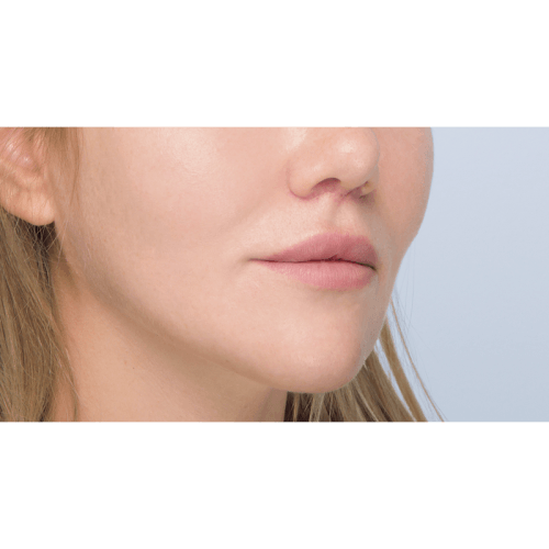 Miszczyk1B-1-aspect-ratio-500-500