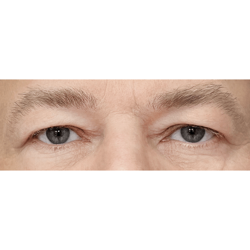 Miszczyk2A-1-aspect-ratio-500-500