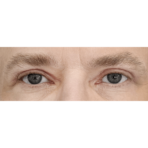 Miszczyk2B-1-aspect-ratio-500-500