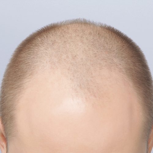 10A-Copy-1-aspect-ratio-500-500