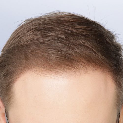 10B-Copy-1-aspect-ratio-500-500