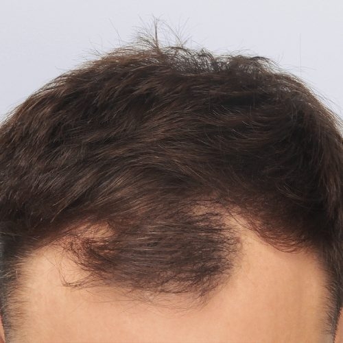 11A-Copy-1-aspect-ratio-500-500