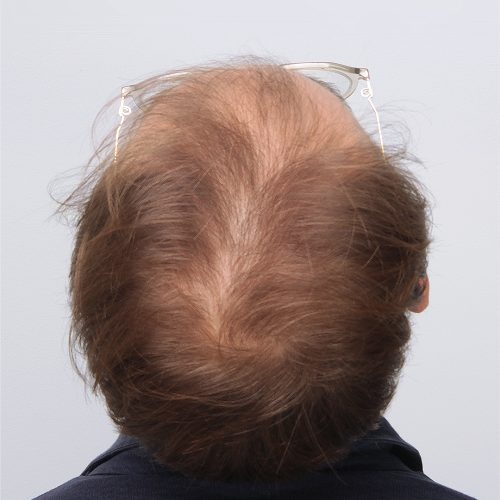 19A-57102--aspect-ratio-500-500