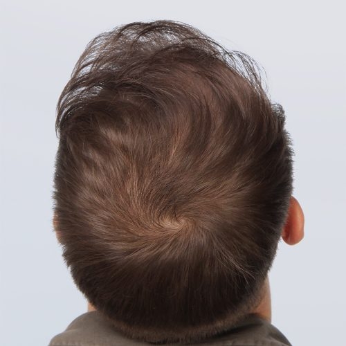 19B-57102--aspect-ratio-500-500