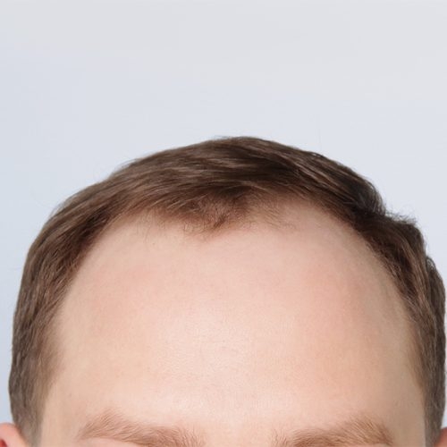 21A-090524-aspect-ratio-500-500