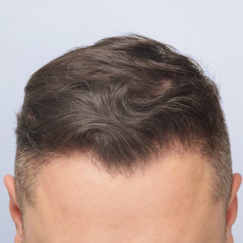 4C-aspect-ratio-500-500