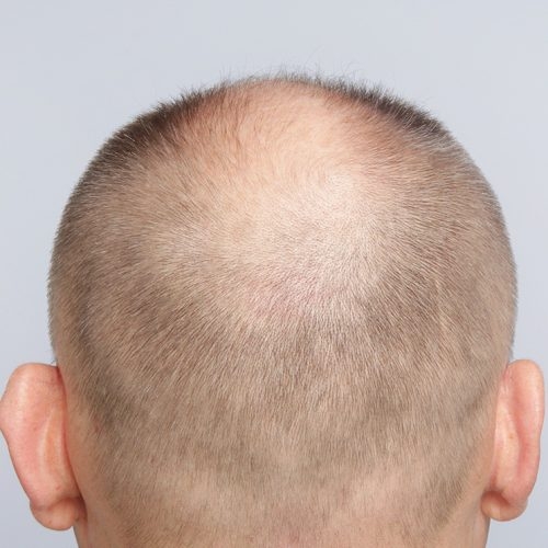 8A-Copy-aspect-ratio-500-500