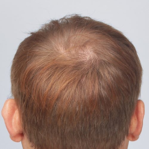 8B-Copy-aspect-ratio-500-500