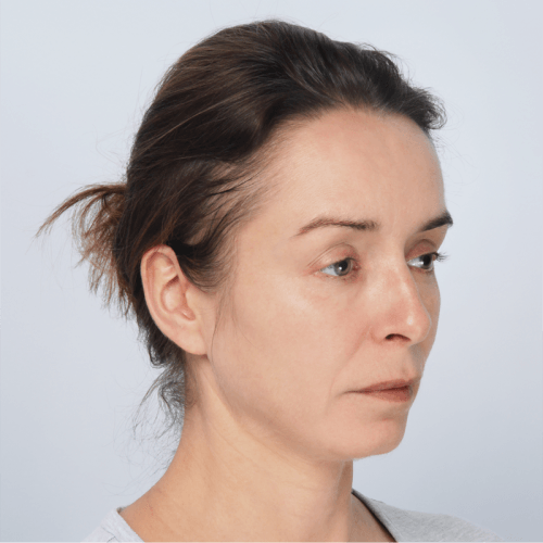 Miszczyk2A-2-aspect-ratio-500-500