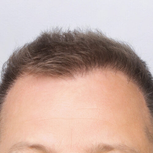 wlosy-30b-aspect-ratio-500-500