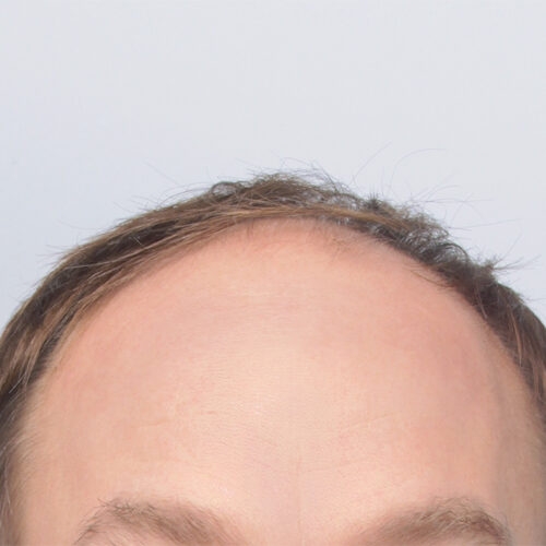 wlosy-31a-aspect-ratio-500-500