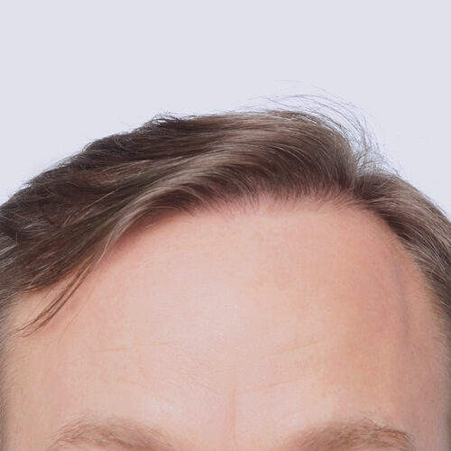 wlosy-31b-aspect-ratio-500-500