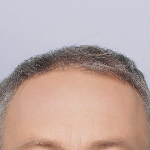 14a-1-aspect-ratio-500-500