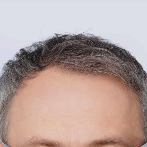 14b-1-aspect-ratio-500-500