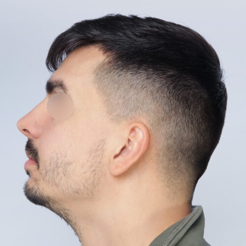 17a-59893-aspect-ratio-500-500