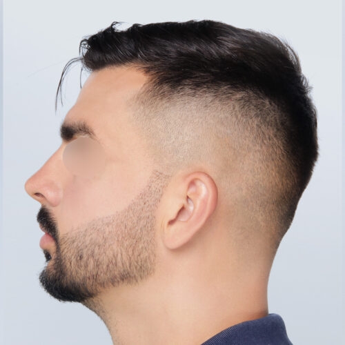 17b-59893-aspect-ratio-500-500