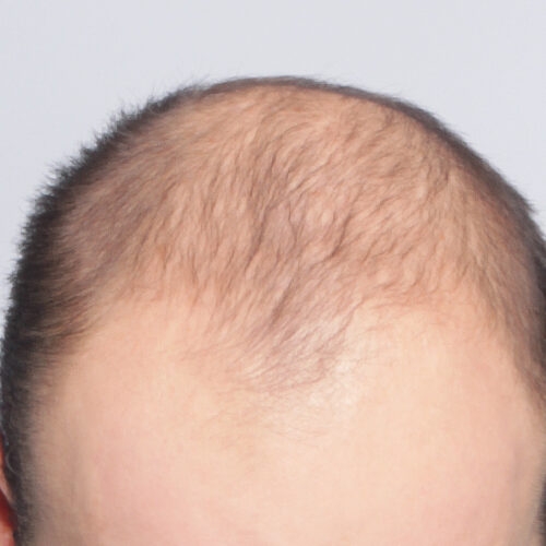 19a-55505-aspect-ratio-500-500