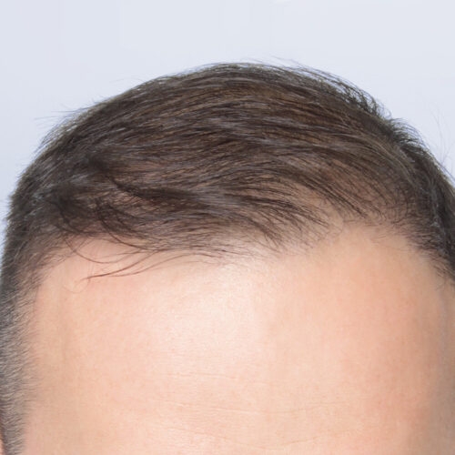 19b-55505-aspect-ratio-500-500