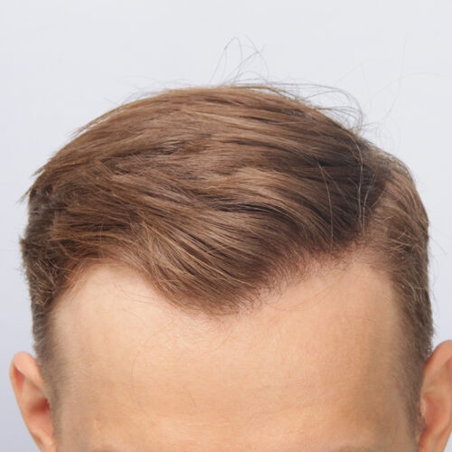 1b-1-aspect-ratio-500-500