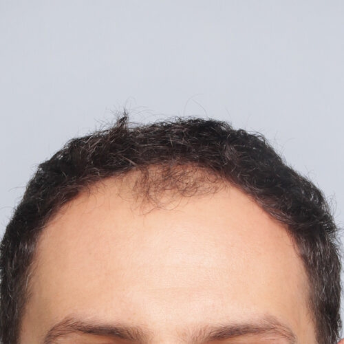 20a-2-aspect-ratio-500-500