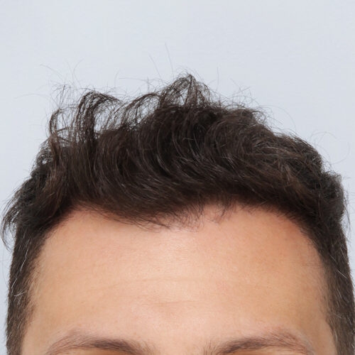 20b-2-aspect-ratio-500-500