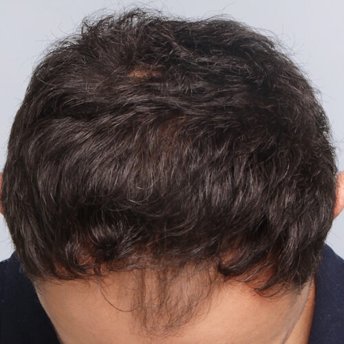 20c-aspect-ratio-500-500