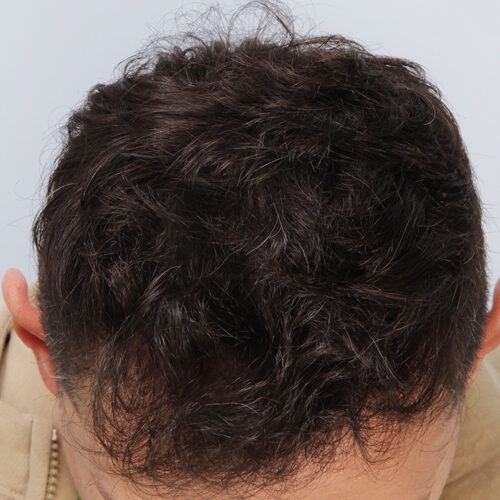 20d-1-aspect-ratio-500-500