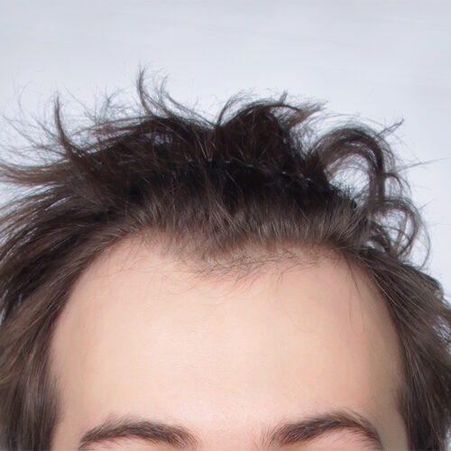 26a-1-aspect-ratio-500-500