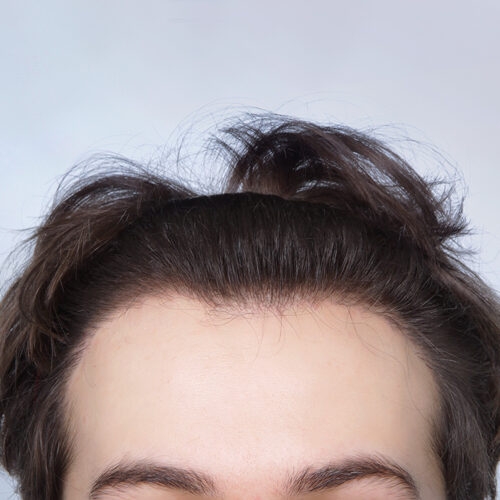 26b-aspect-ratio-500-500