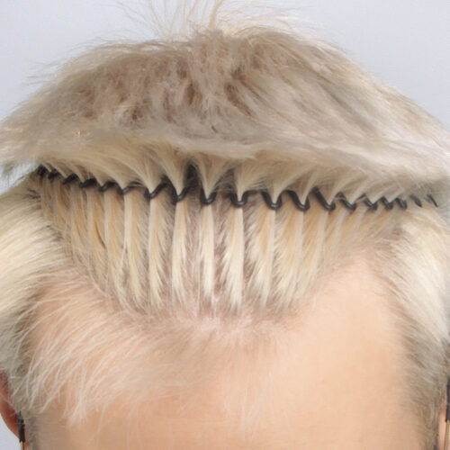 9a-aspect-ratio-500-500