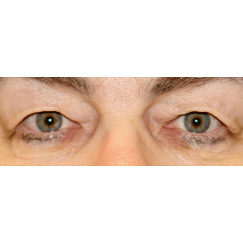 michal2a-aspect-ratio-500-500