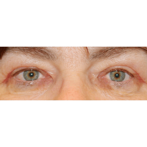 michal2b-aspect-ratio-500-500