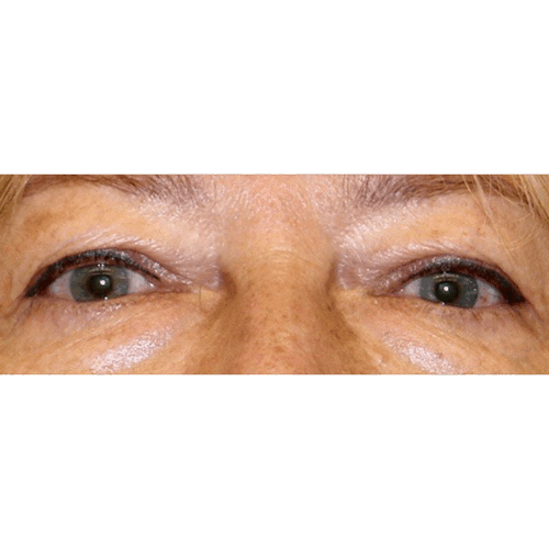 michal3a-aspect-ratio-500-500