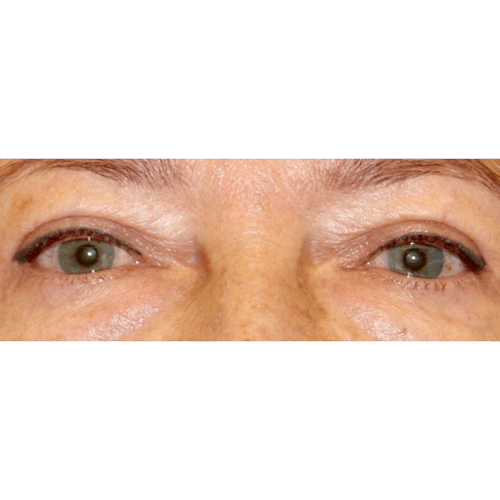 michal3b-aspect-ratio-500-500