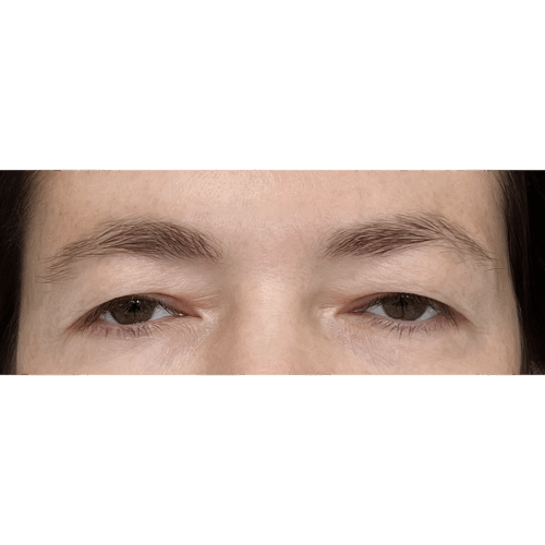 miszczyk1a-2-aspect-ratio-500-500