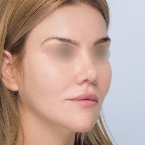 miszczyk1d-aspect-ratio-500-500