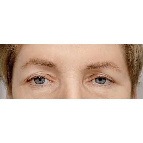 miszczyk2a-aspect-ratio-500-500