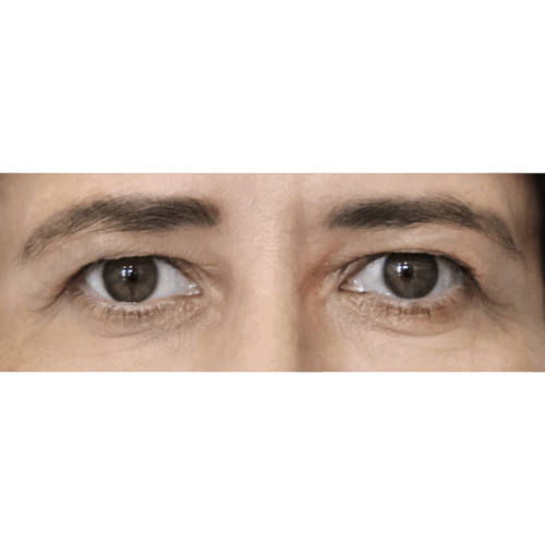 miszczyk3a-aspect-ratio-500-500