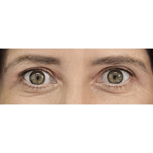 miszczyk3b-aspect-ratio-500-500