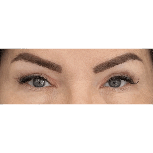 miszczyk5b-aspect-ratio-500-500