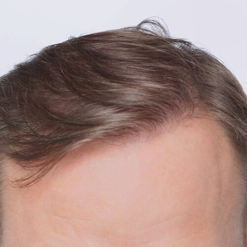 wlosy-31d-aspect-ratio-500-500