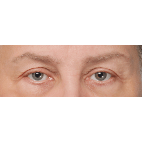 Daria1A-58233-aspect-ratio-500-500