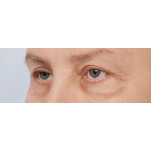 Daria2A-58233-aspect-ratio-500-500