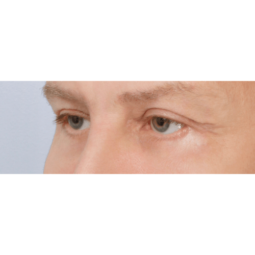 Daria2B-58233-aspect-ratio-500-500