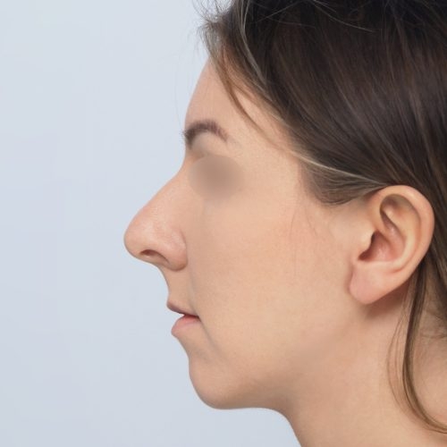 Daria4A-58373-aspect-ratio-500-500