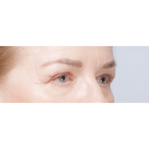 Ferenc-powieki-sameoczy-63608-2B-aspect-ratio-500-500