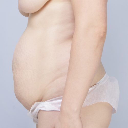 Ferenc1A-aspect-ratio-500-500