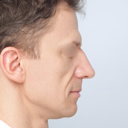 Kulicki7A-56487-aspect-ratio-500-500